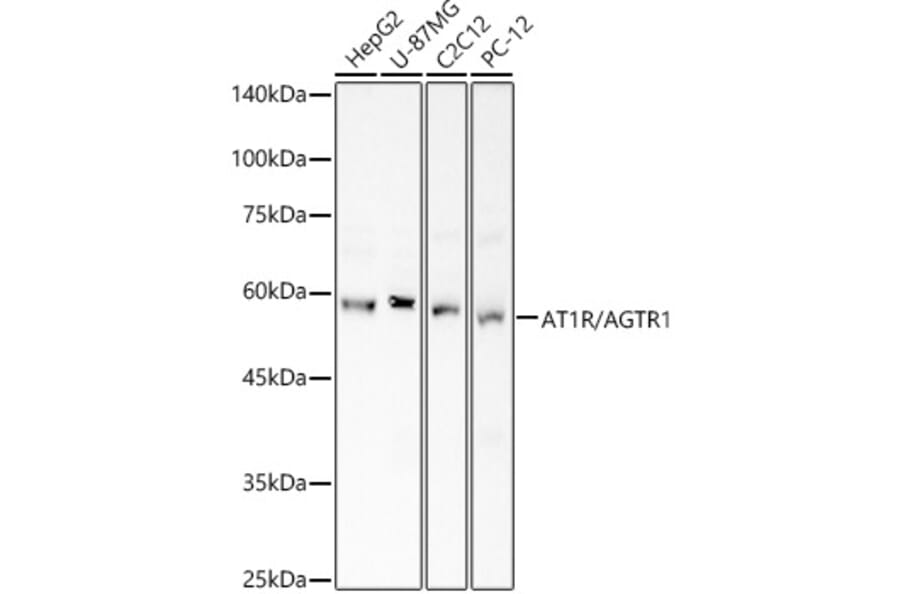 Western Blot - Anti-Angiotensin II Type 1 Receptor Antibody (A90187) - Antibodies.com