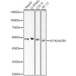 Western Blot - Anti-Angiotensin II Type 1 Receptor Antibody (A90187) - Antibodies.com