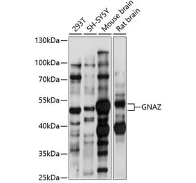 Western Blot - Anti-GNAZ Antibody (A90188) - Antibodies.com