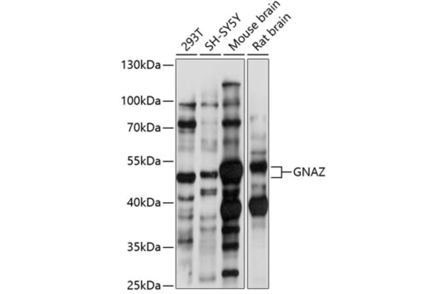 Western Blot - Anti-GNAZ Antibody (A90188) - Antibodies.com