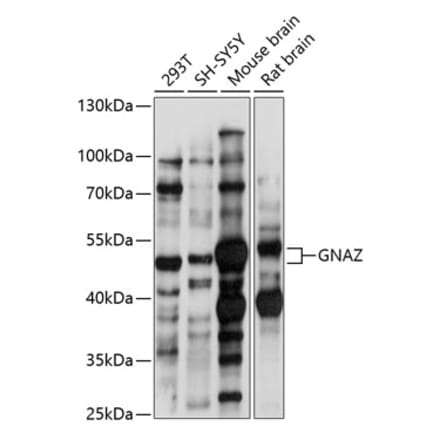 Western Blot - Anti-GNAZ Antibody (A90188) - Antibodies.com