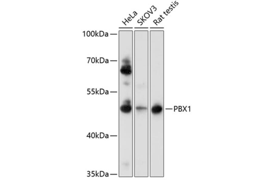 Western Blot - Anti-PBX1 Antibody (A0124) - Antibodies.com