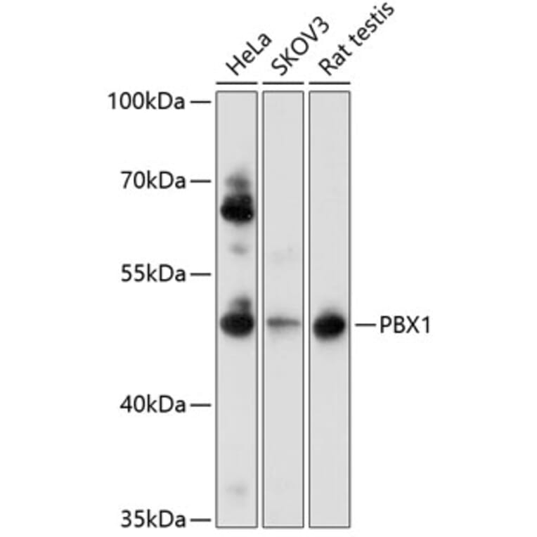 Western Blot - Anti-PBX1 Antibody (A0124) - Antibodies.com