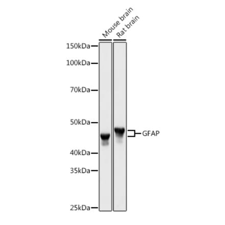 Western Blot - Anti-GFAP Antibody (A90190) - Antibodies.com