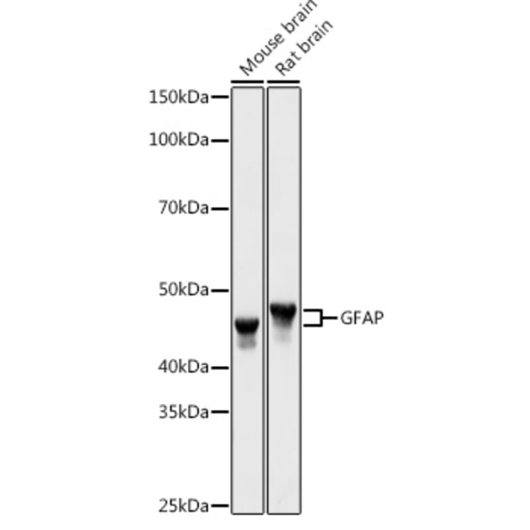 Western Blot - Anti-GFAP Antibody (A90190) - Antibodies.com