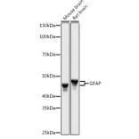 Western Blot - Anti-GFAP Antibody (A90190) - Antibodies.com