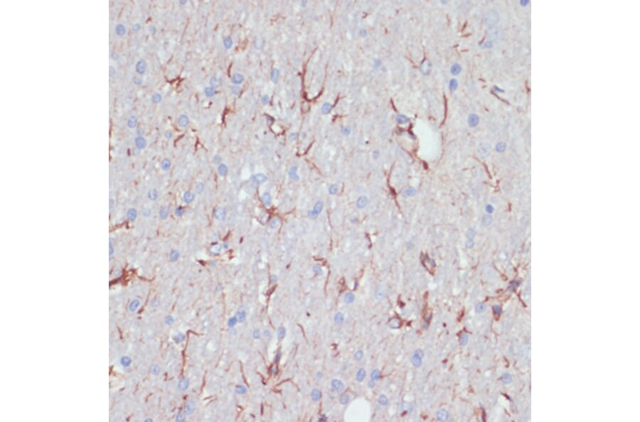 Immunohistochemistry - Anti-GFAP Antibody (A90190) - Antibodies.com