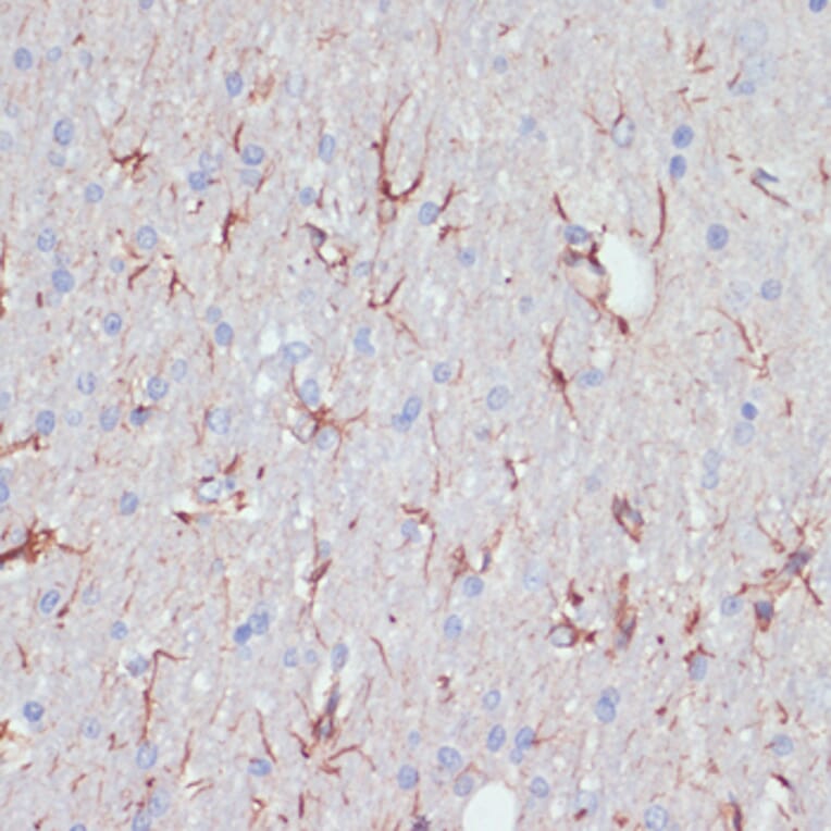 Immunohistochemistry - Anti-GFAP Antibody (A90190) - Antibodies.com