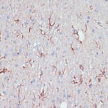 Immunohistochemistry - Anti-GFAP Antibody (A90190) - Antibodies.com