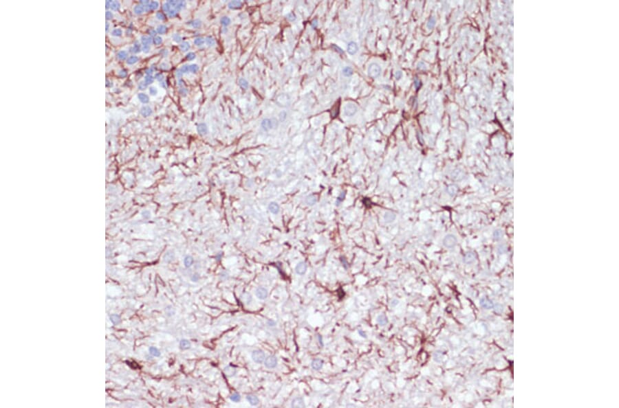 Immunohistochemistry - Anti-GFAP Antibody (A90190) - Antibodies.com
