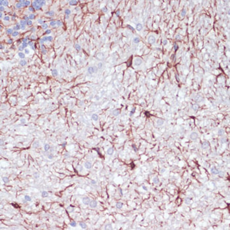 Immunohistochemistry - Anti-GFAP Antibody (A90190) - Antibodies.com