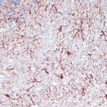 Immunohistochemistry - Anti-GFAP Antibody (A90190) - Antibodies.com