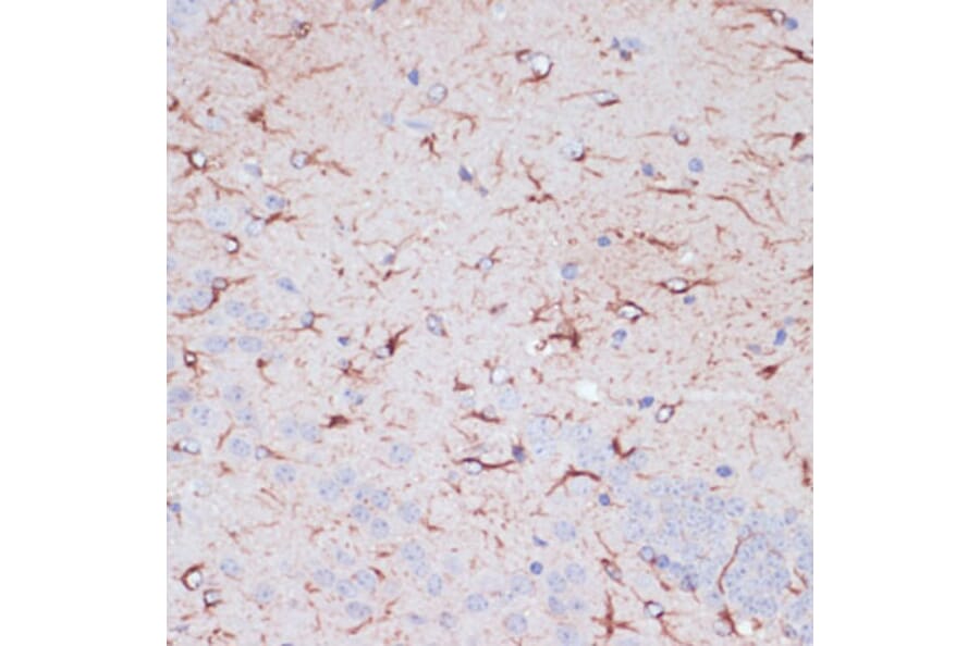 Immunohistochemistry - Anti-GFAP Antibody (A90190) - Antibodies.com