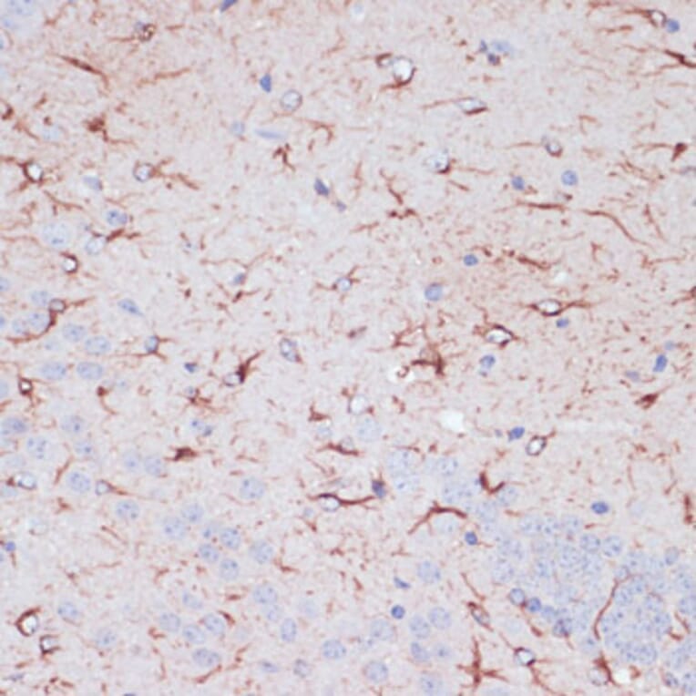 Immunohistochemistry - Anti-GFAP Antibody (A90190) - Antibodies.com