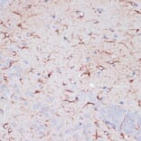 Immunohistochemistry - Anti-GFAP Antibody (A90190) - Antibodies.com