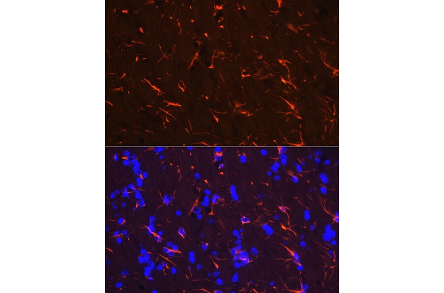Immunofluorescence - Anti-GFAP Antibody (A90190) - Antibodies.com