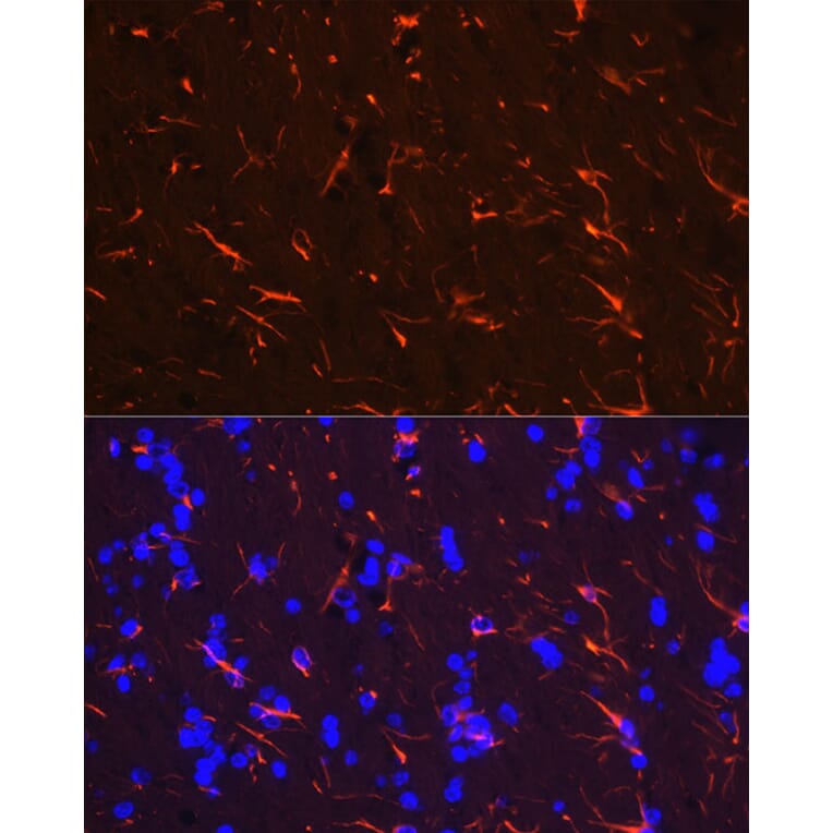 Immunofluorescence - Anti-GFAP Antibody (A90190) - Antibodies.com