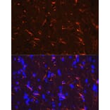 Immunofluorescence - Anti-GFAP Antibody (A90190) - Antibodies.com