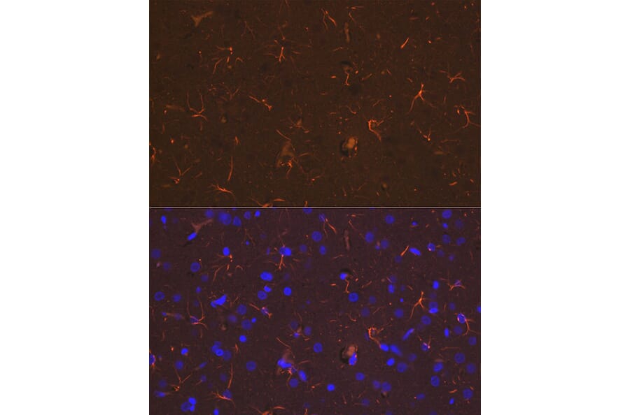 Immunofluorescence - Anti-GFAP Antibody (A90190) - Antibodies.com
