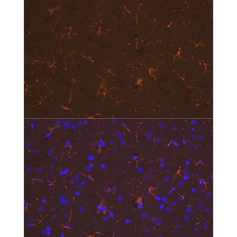 Immunofluorescence - Anti-GFAP Antibody (A90190) - Antibodies.com