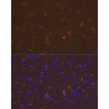 Immunofluorescence - Anti-GFAP Antibody (A90190) - Antibodies.com