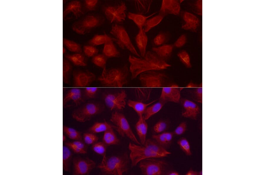 Immunofluorescence - Anti-GFAP Antibody (A90190) - Antibodies.com