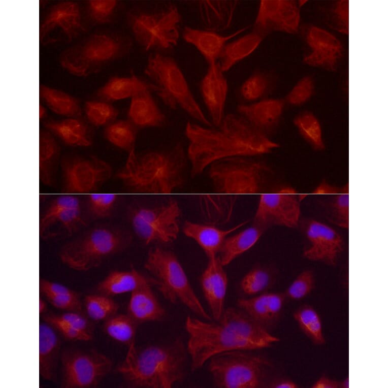 Immunofluorescence - Anti-GFAP Antibody (A90190) - Antibodies.com