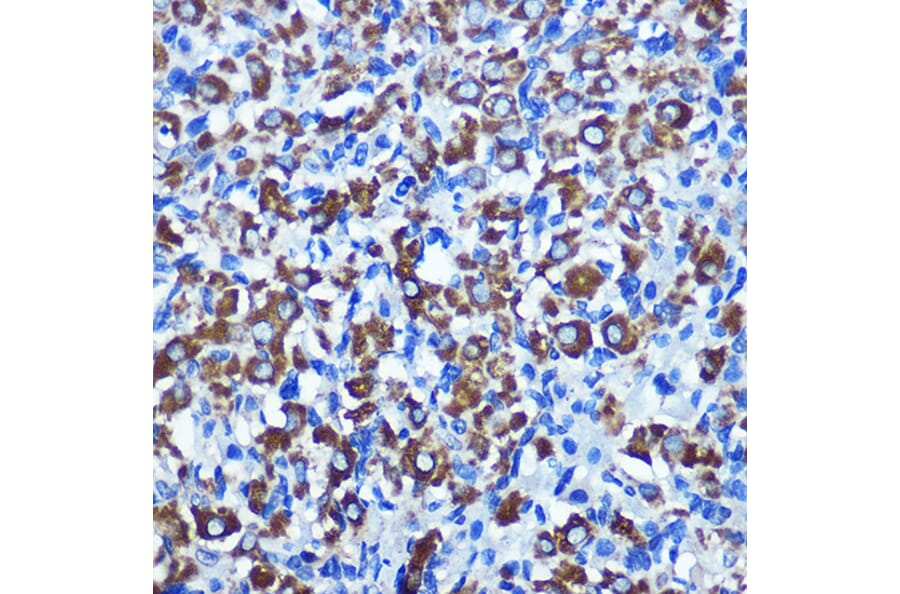 Immunohistochemistry - Anti-NEK2 Antibody (A90191) - Antibodies.com