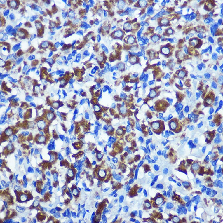 Immunohistochemistry - Anti-NEK2 Antibody (A90191) - Antibodies.com