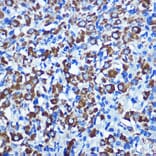 Immunohistochemistry - Anti-NEK2 Antibody (A90191) - Antibodies.com
