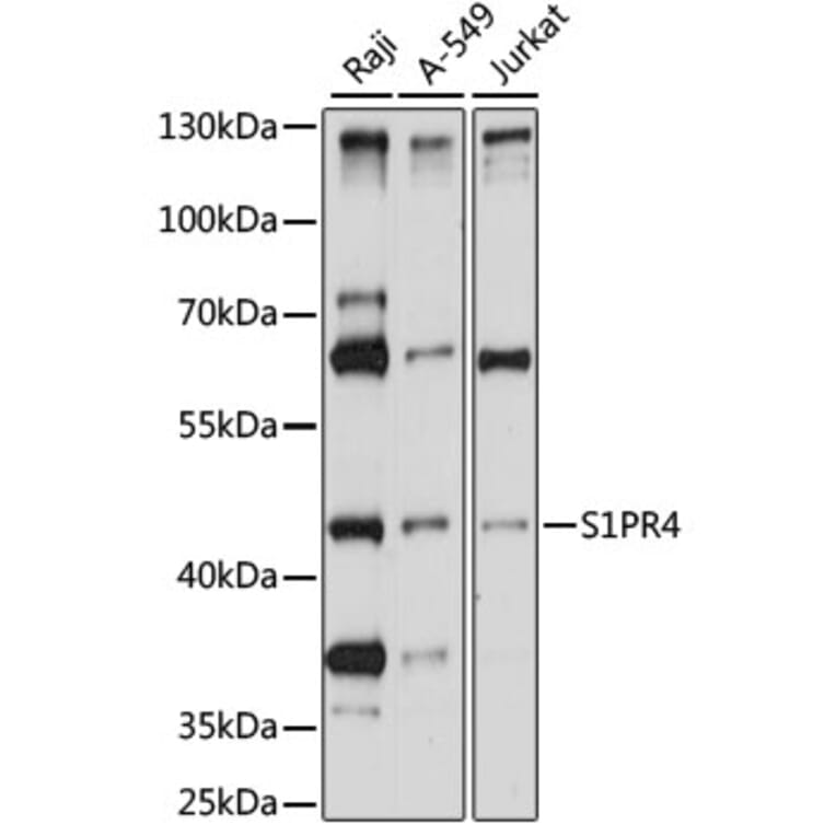 Western Blot - Anti-EDG6/S1PR4 Antibody (A90192) - Antibodies.com
