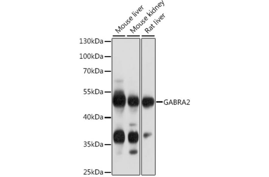 Western Blot - Anti-GABA A Receptor alpha 2/GABRA2 Antibody (A90194) - Antibodies.com