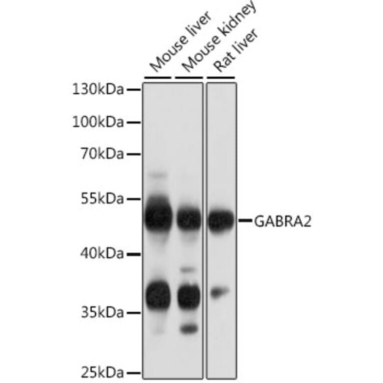 Western Blot - Anti-GABA A Receptor alpha 2/GABRA2 Antibody (A90194) - Antibodies.com