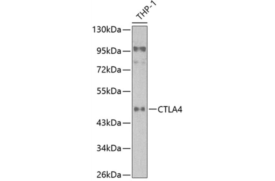 Western Blot - Anti-CTLA4 Antibody (A90195) - Antibodies.com
