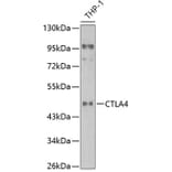 Western Blot - Anti-CTLA4 Antibody (A90195) - Antibodies.com