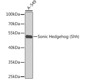 Western Blot - Anti-Sonic Hedgehog Antibody (A90196) - Antibodies.com