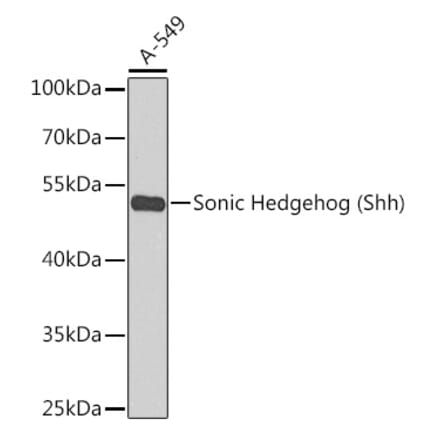 Western Blot - Anti-Sonic Hedgehog Antibody (A90196) - Antibodies.com