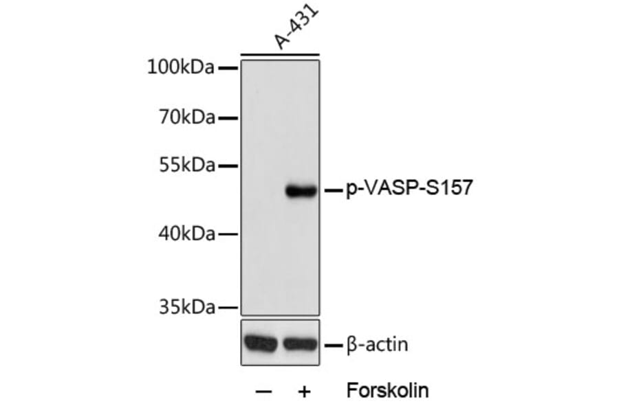 Western Blot - Anti-VASP (phospho Ser157) Antibody (A90197) - Antibodies.com