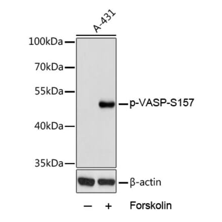 Western Blot - Anti-VASP (phospho Ser157) Antibody (A90197) - Antibodies.com