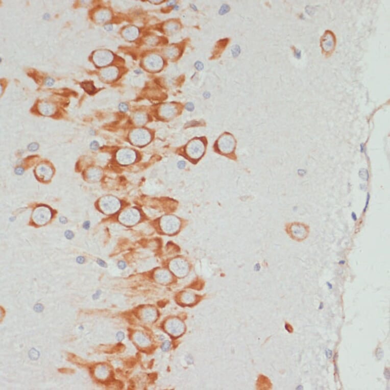 Immunohistochemistry - Anti-VASP (phospho Ser157) Antibody (A90197) - Antibodies.com