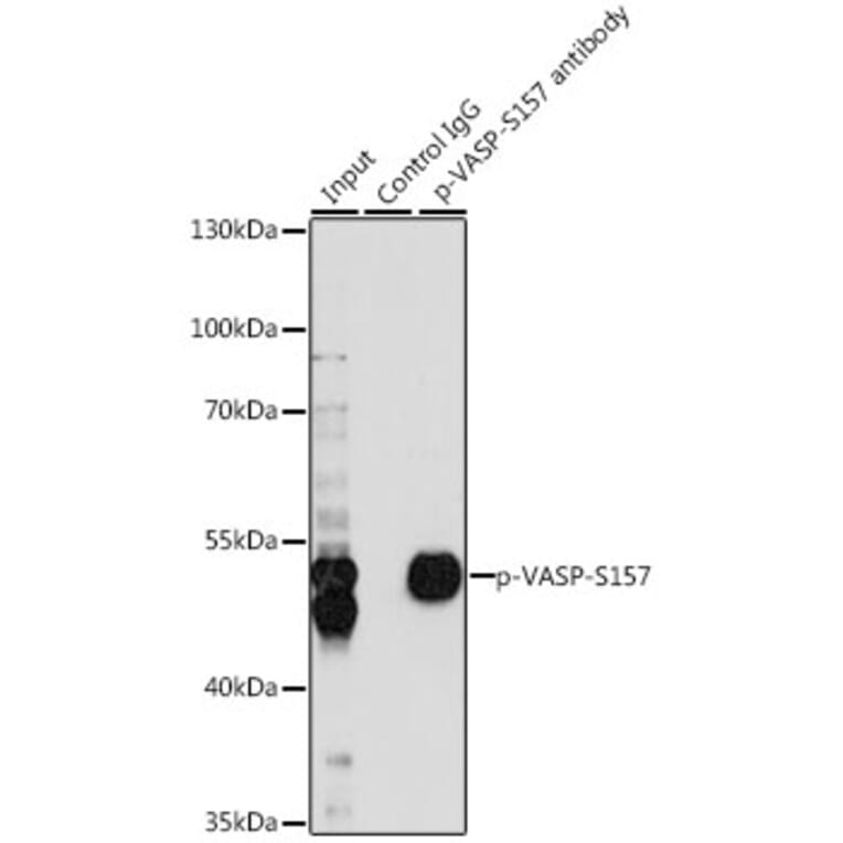 Western Blot - Anti-VASP (phospho Ser157) Antibody (A90197) - Antibodies.com