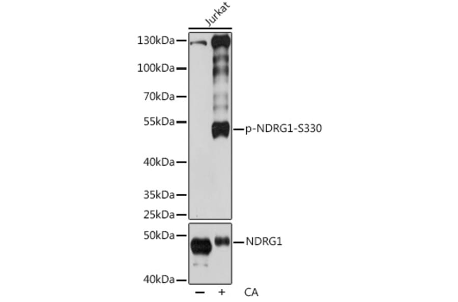 Western Blot - Anti-NDRG1 (phospho Ser330) Antibody (A90198) - Antibodies.com
