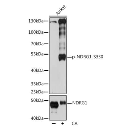 Western Blot - Anti-NDRG1 (phospho Ser330) Antibody (A90198) - Antibodies.com