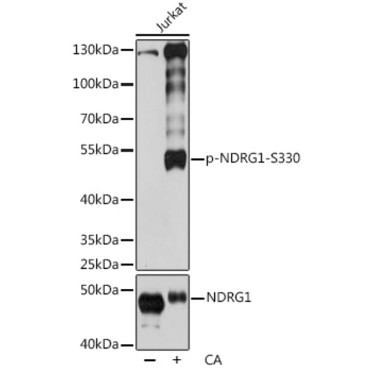 Western Blot - Anti-NDRG1 (phospho Ser330) Antibody (A90198) - Antibodies.com