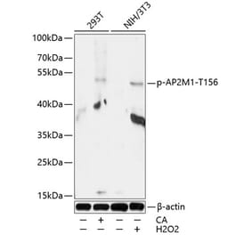 Western Blot - Anti-AP2M1 (phospho Thr156) Antibody (A90199) - Antibodies.com