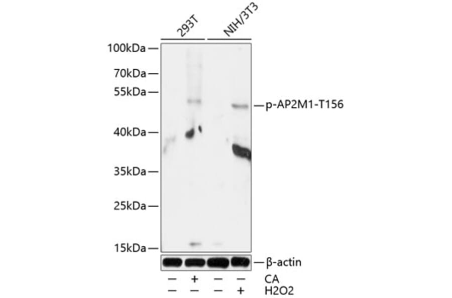 Western Blot - Anti-AP2M1 (phospho Thr156) Antibody (A90199) - Antibodies.com