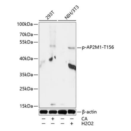Western Blot - Anti-AP2M1 (phospho Thr156) Antibody (A90199) - Antibodies.com