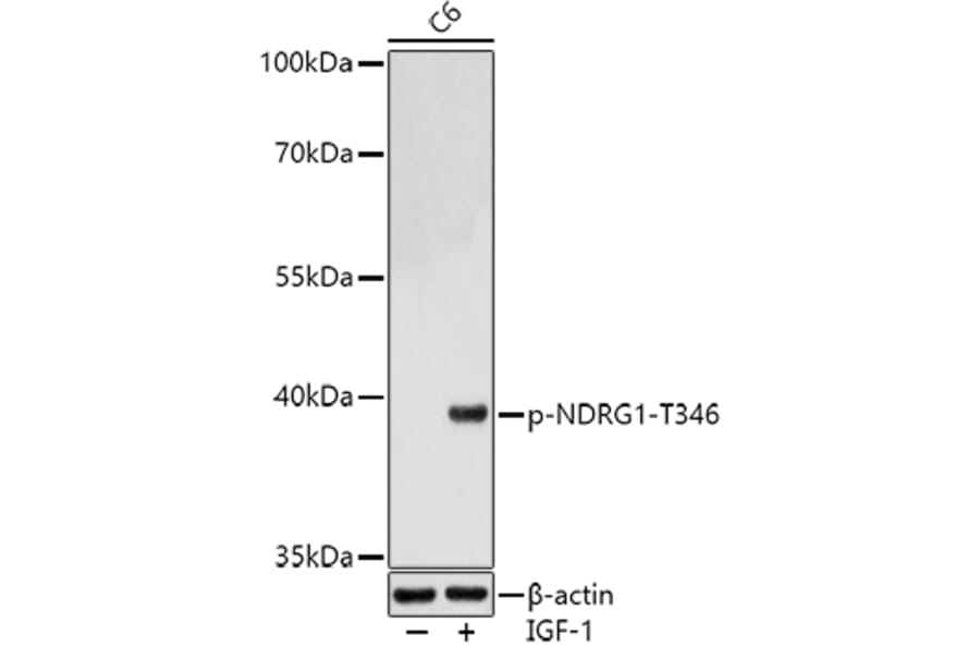 Western Blot - Anti-NDRG1 (phospho Thr346) Antibody (A90200) - Antibodies.com