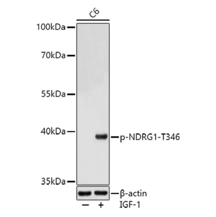 Western Blot - Anti-NDRG1 (phospho Thr346) Antibody (A90200) - Antibodies.com