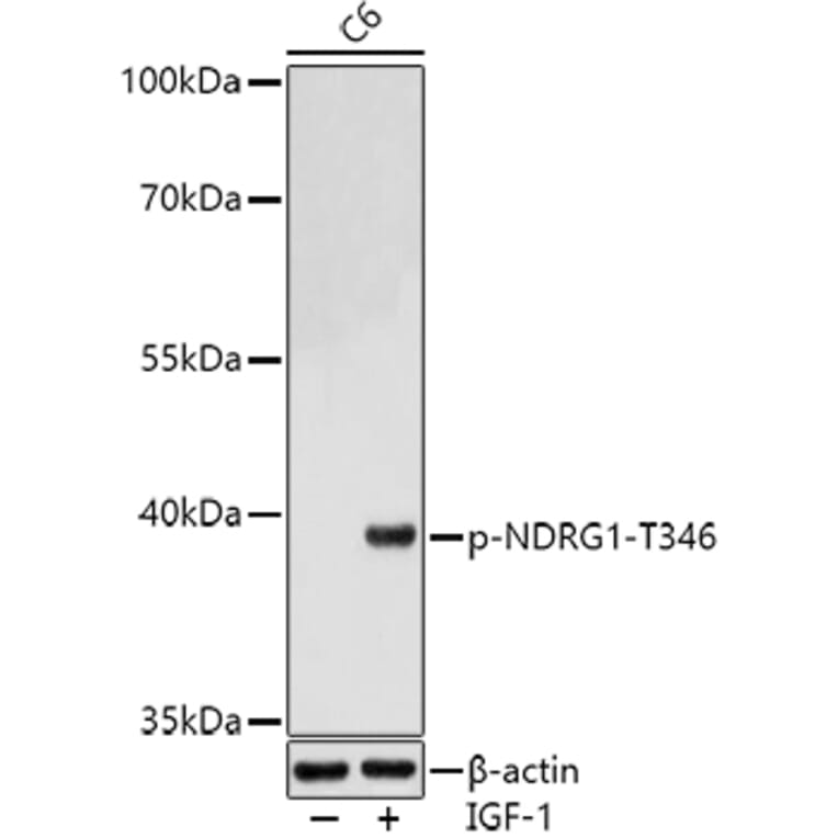 Western Blot - Anti-NDRG1 (phospho Thr346) Antibody (A90200) - Antibodies.com